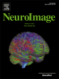 Read more about the article Paper published in NeuroImage!