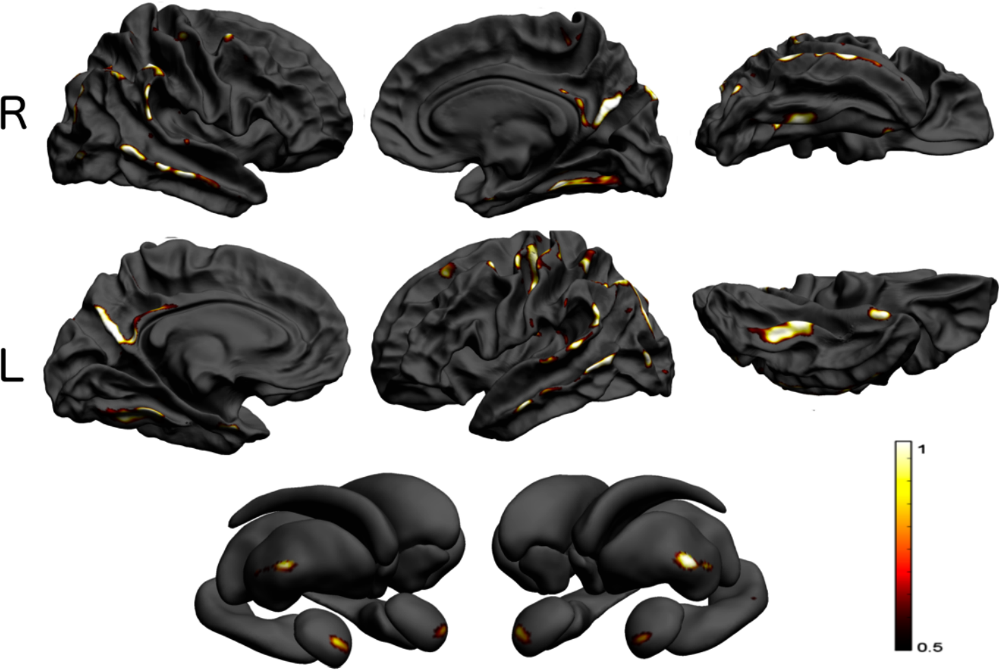 Read more about the article Imaging genetics paper now online at PNAS!